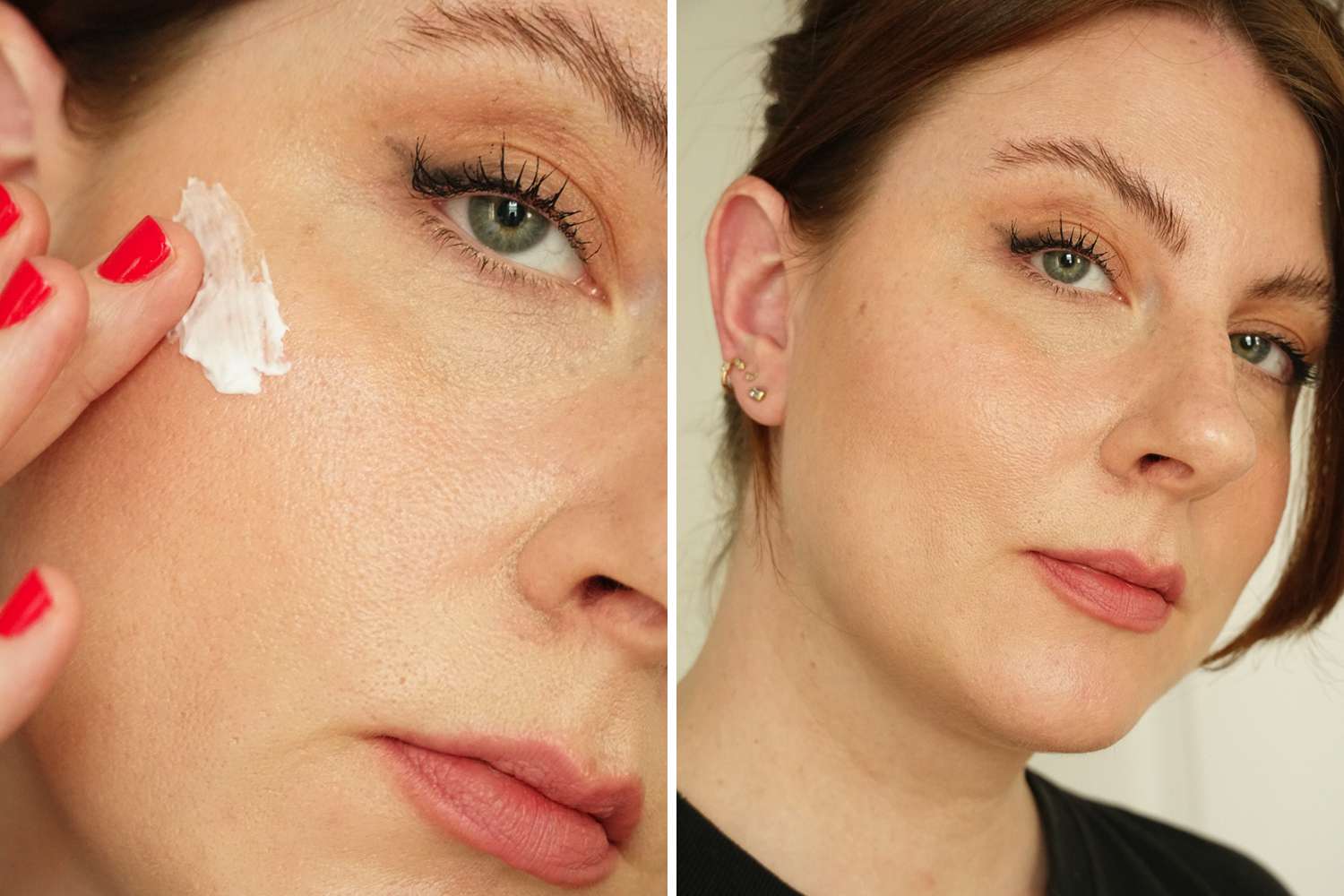 What are the side effects of skin tightening? post thumbnail image