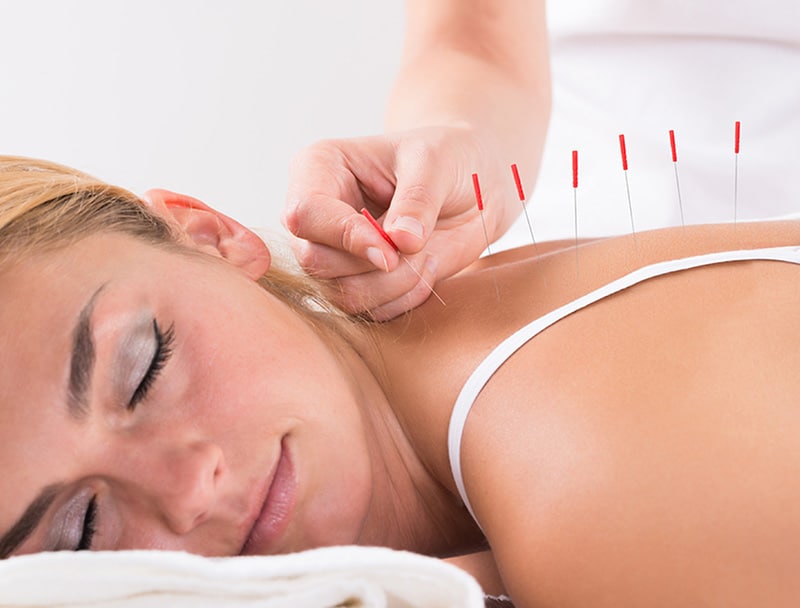 Pharmacological treatments can complement therapies acupuncture North York post thumbnail image