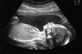 Long-term benefits associated with developing a fake ultrasound readily available post thumbnail image