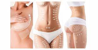 Getting the Best Abdominoplasty Results in Miami: What to Know post thumbnail image